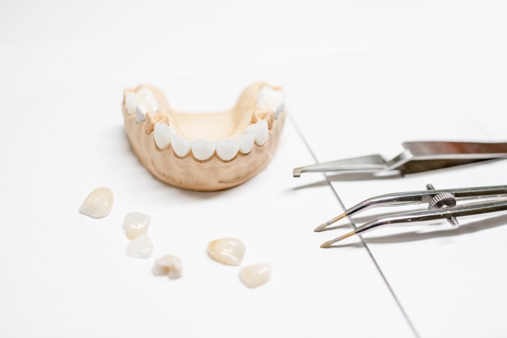 The Best Dentist in Turkey for Veneers (Antalya, Kusadasi and Istanbul) 2 artificial jaw model with veneers 5ETQX6U min