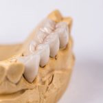 Is Zirconia Crowns Better than Porcelain Crowns?