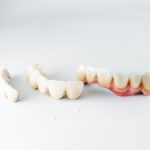 Procés de carilles dentals