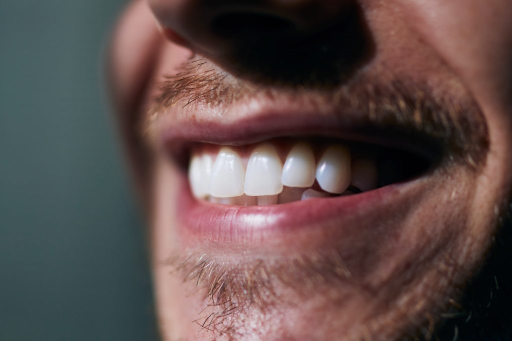 Alanya Hollywood Smile Makeover Prices - Dental Clinics 3 toothy smile of young man close up view of white t VAGRGM8 min