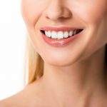 How Much Does a Full Set of Veneers Cost in the UK?
