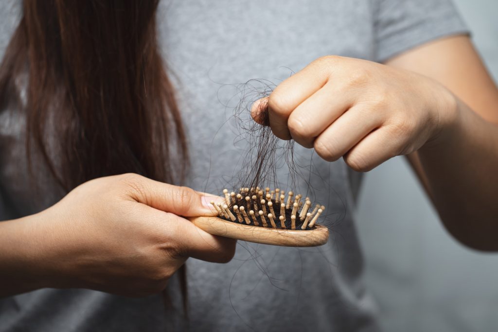 e donne anu prublemi di perdita di capelli NTHMY4L min