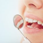 Цени за забни импланти во Полска, квалитетни забни импланти