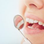 Costos dels implants de Dubrovnik: quant costen els implants dentals a Croàcia?