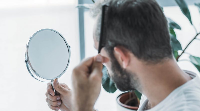 transplante de cabelo