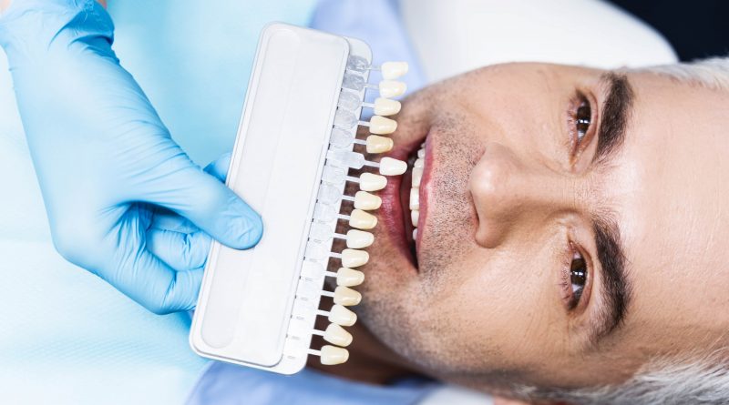 Цены на стоматологические виниры в Германии - Стоматологическая клиника