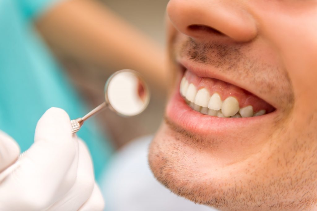 What is the Cost of Getting Dental Veneers Abroad, Turkey?