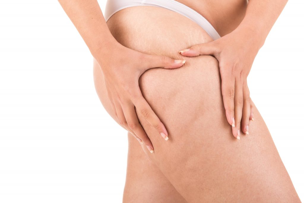 How Much Does it Cost to Get Liposuction in Turkey?