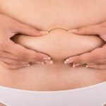 Is Liposuction a Weight Loss Surgery? Fat Removal Treatment in Turkey