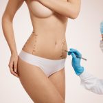 Liposuction Costs in Istanbul- Where and How to Get the Cheapest?
