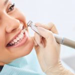 How to Get a Hollywood Smile in Antalya? Affordable Costs