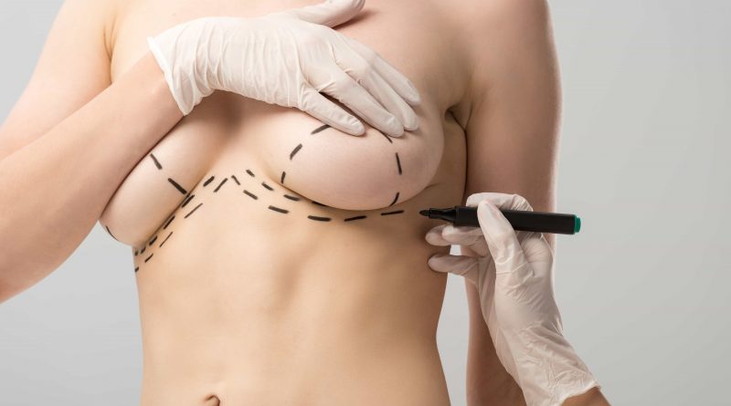 Tani lifting piersi w Stambule w Turcji: procedura i pakiety