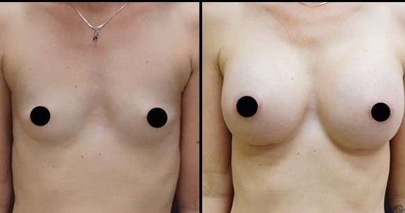 1 1