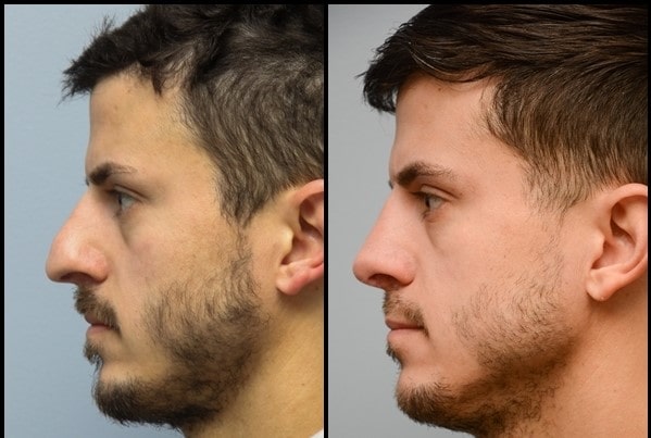 13 2 min