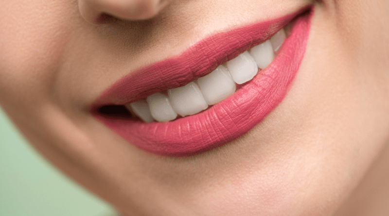 thailand dental treatment dental implant dental veneer hollywood smile bangkok