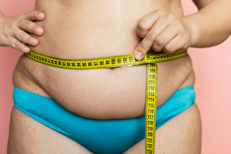 pagkatapos ng Weight Loss Surgery