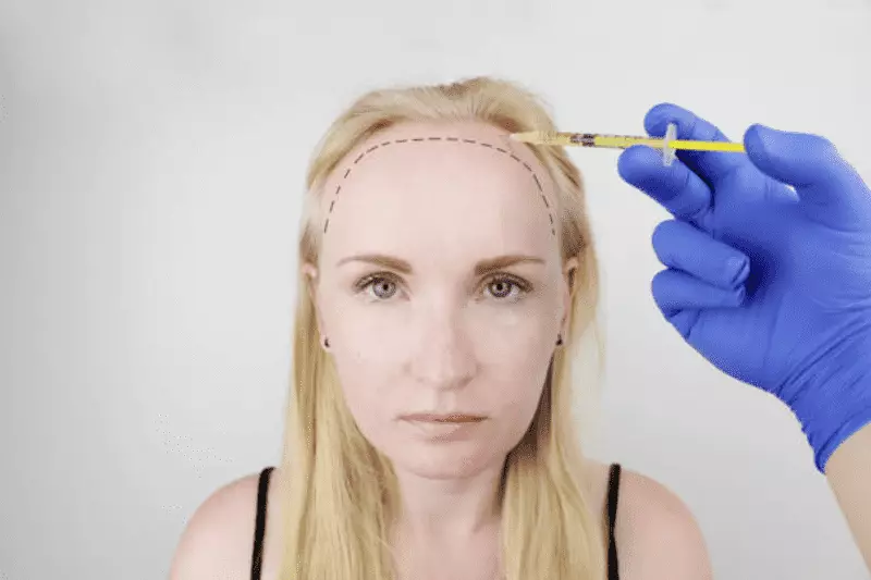 What Is Women Hair Transplant in Turkey? Causes, Remedies, and Price 8 Background 25 1