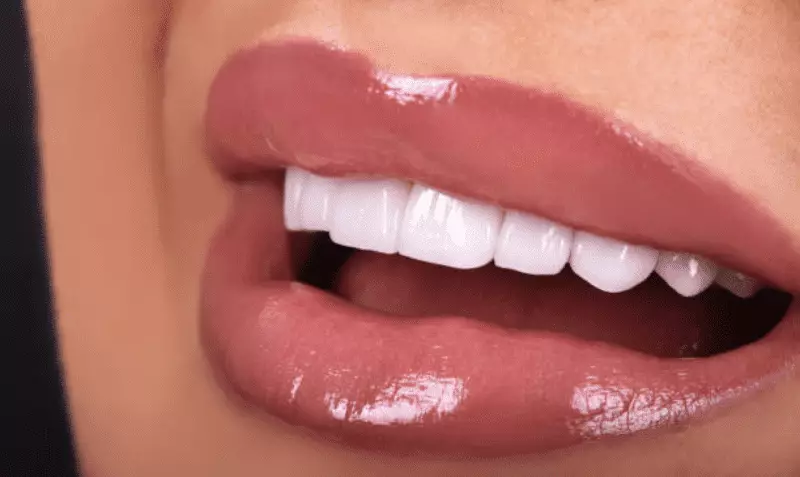 Ways to Get Free Dental Implants in the USA 2 dental Implant prices in Turkey