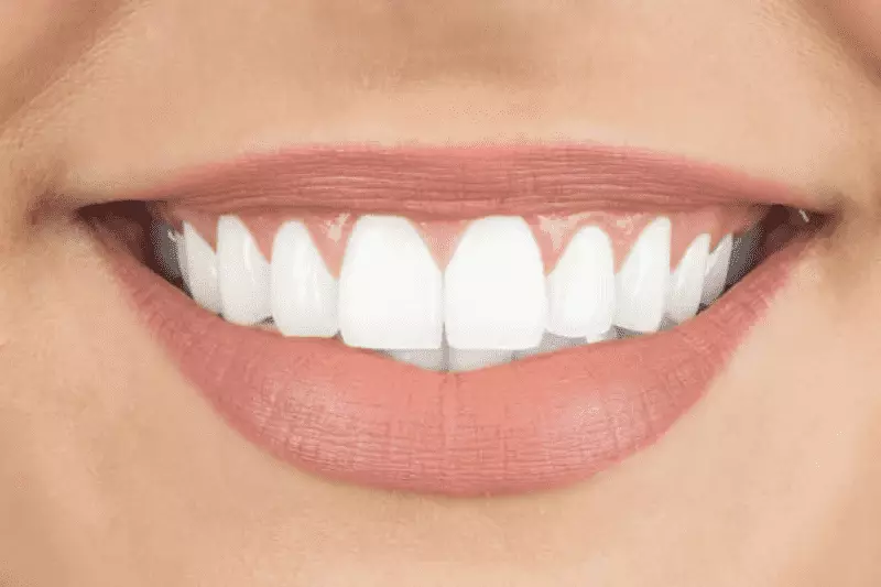 Teeth Whitening Treatment Prices in Turkey 7 Background 30 2