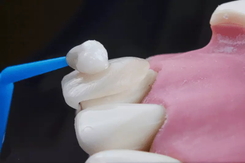 How Much Is Hollywood Smile in Czechia? 2 Hollywood Smile in Czechia Prices