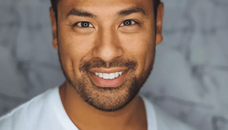 hollywood smile