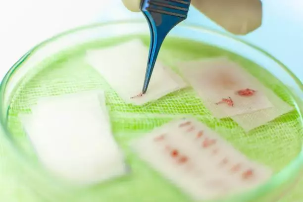 What Is Women Hair Transplant in Turkey? Causes, Remedies, and Price 12 istockphoto 1154891337 612x612 2