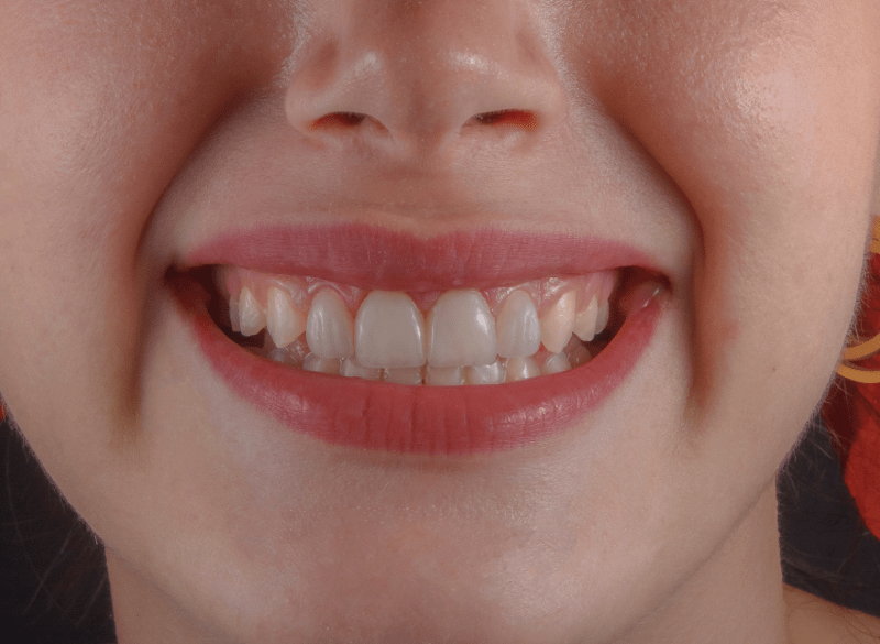 dental care cost in albania