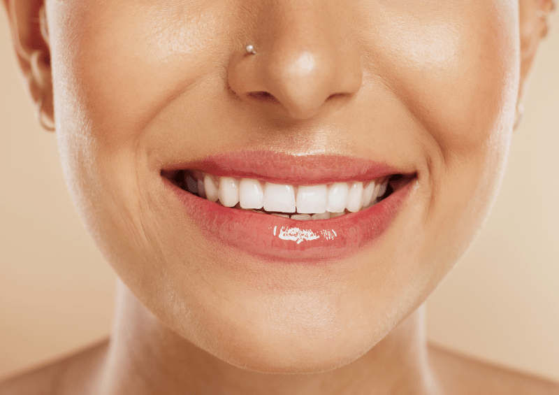 Hollywood Smile Cost in Brazil