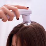 hair transplant for women in turkey price