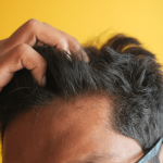 hair transplants in turkey