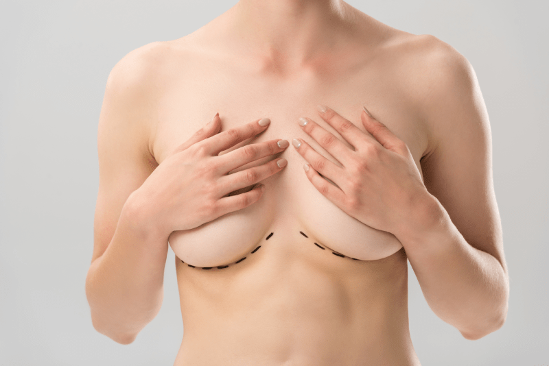 Breast Augmentation Surgeons in Turkey