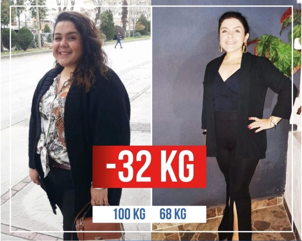 Which Weight Loss Treatment Is Best For Me 8 cscs