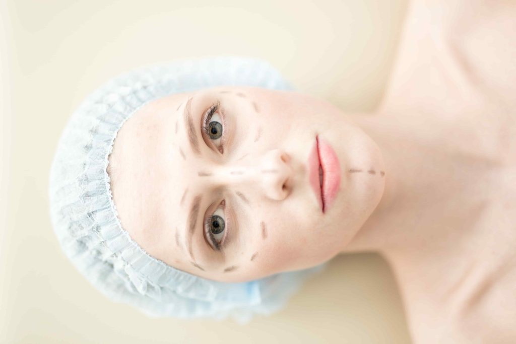Almond Eye Surgery Prices in Turkey 3 plastic surgery 2021 09 24 02 47 56 utc min