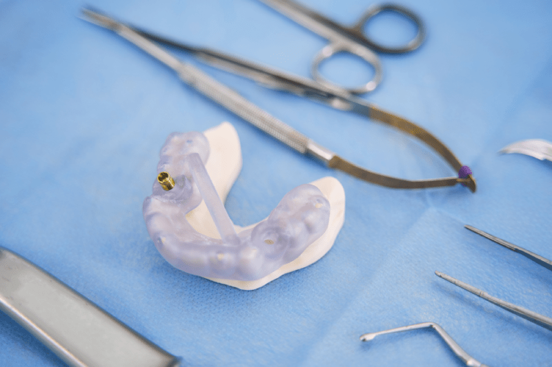 Izmir Cesme Best Dental Clinics - Cesme Dental Implant Treatment and Prices 2 Dental Implant