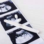 Pregnant After Gastric Sleeve Surgery