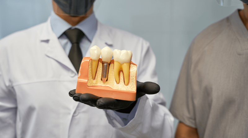 dental susuk