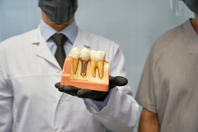 Implant Dental