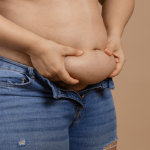 tummy tuck or liposuction