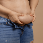 abdominoplastie sau liposuctie