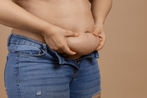 tummy tuck or liposuction