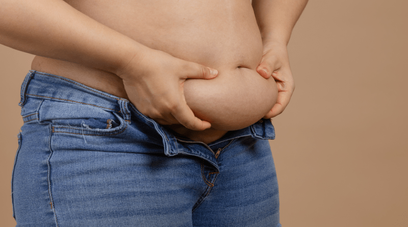 tummy tuck atanapi liposuction