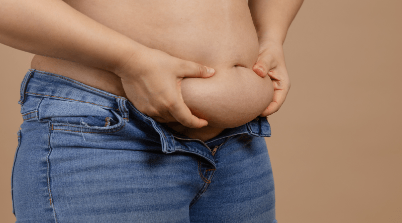 abdominoplastia ou lipoaspiração