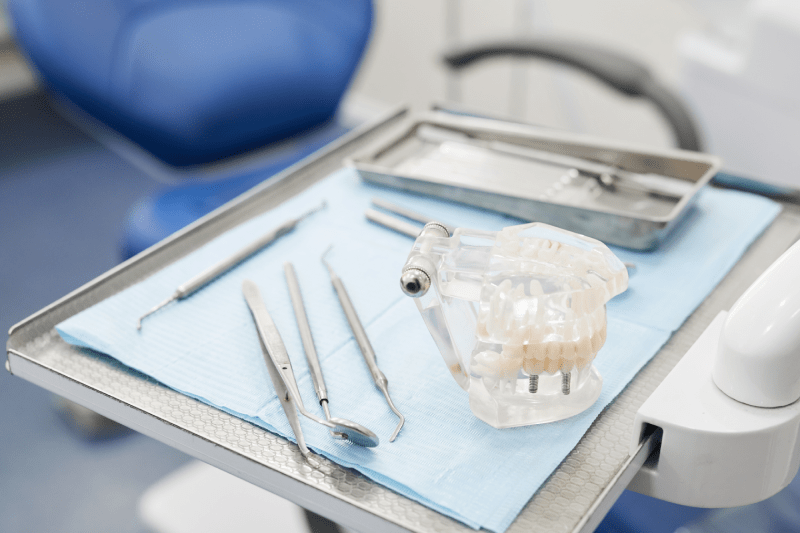 Dental implantare UK