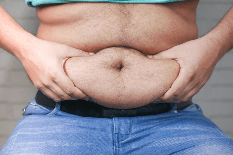 Gastric Sleeve in Istanbul
