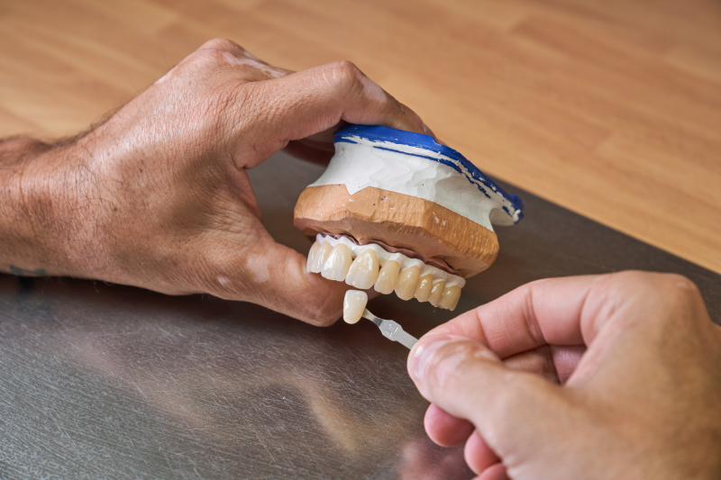 Dental Crowns