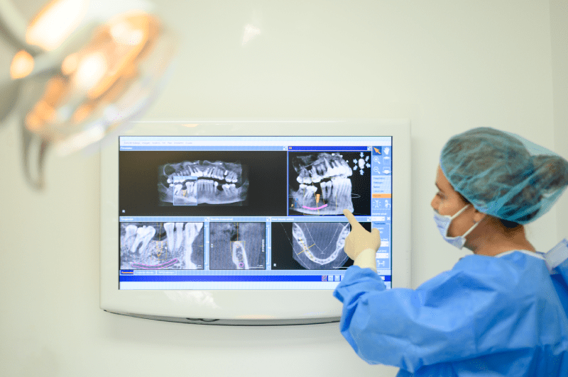 Izmir Cesme Best Dental Clinics - Cesme Dental Implant Treatment and Prices 4 Dental Implant