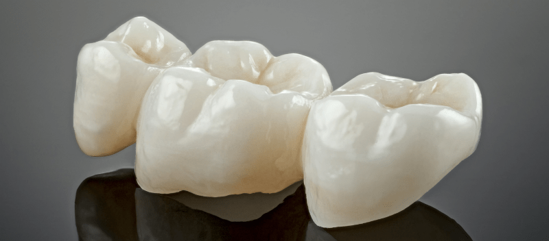 Dental Crowns