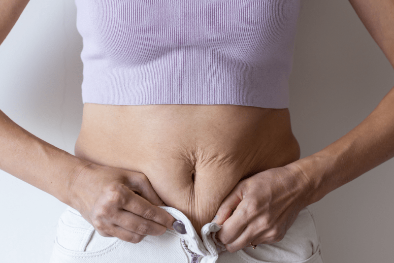 abdominoplastia ou lipoaspiração