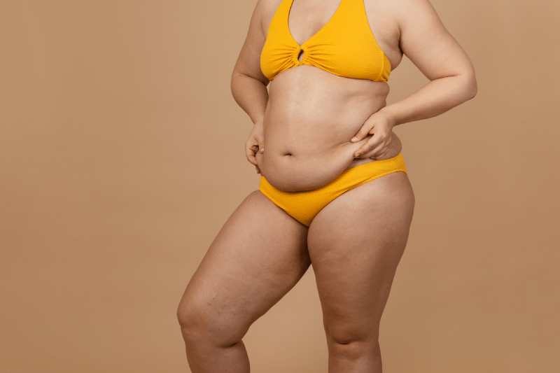 Does The Skin Sag After Weight Loss? Effective Solutions To Skin Sagging After Weight Loss 2 Skin Sagging After Weight Loss
