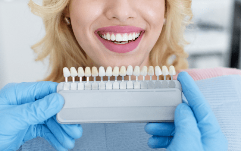 Zirconium Veneers Price UK 2023 - Zirconium Dental Veneers Advantages 3 Zirconium Veneers Price UK